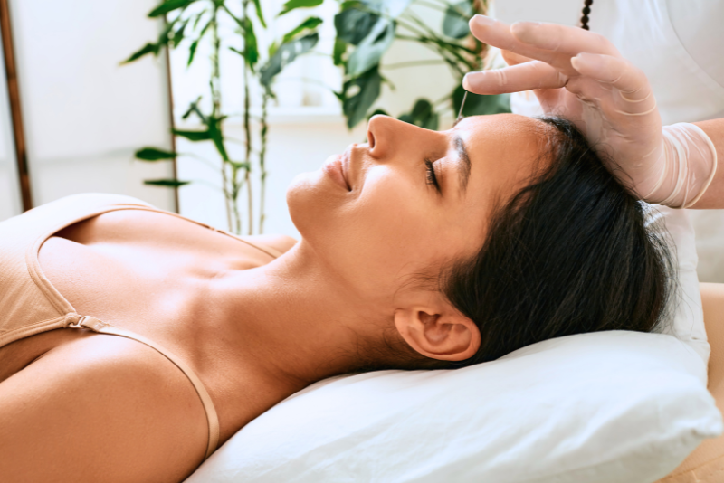 acupuncture in Toronto