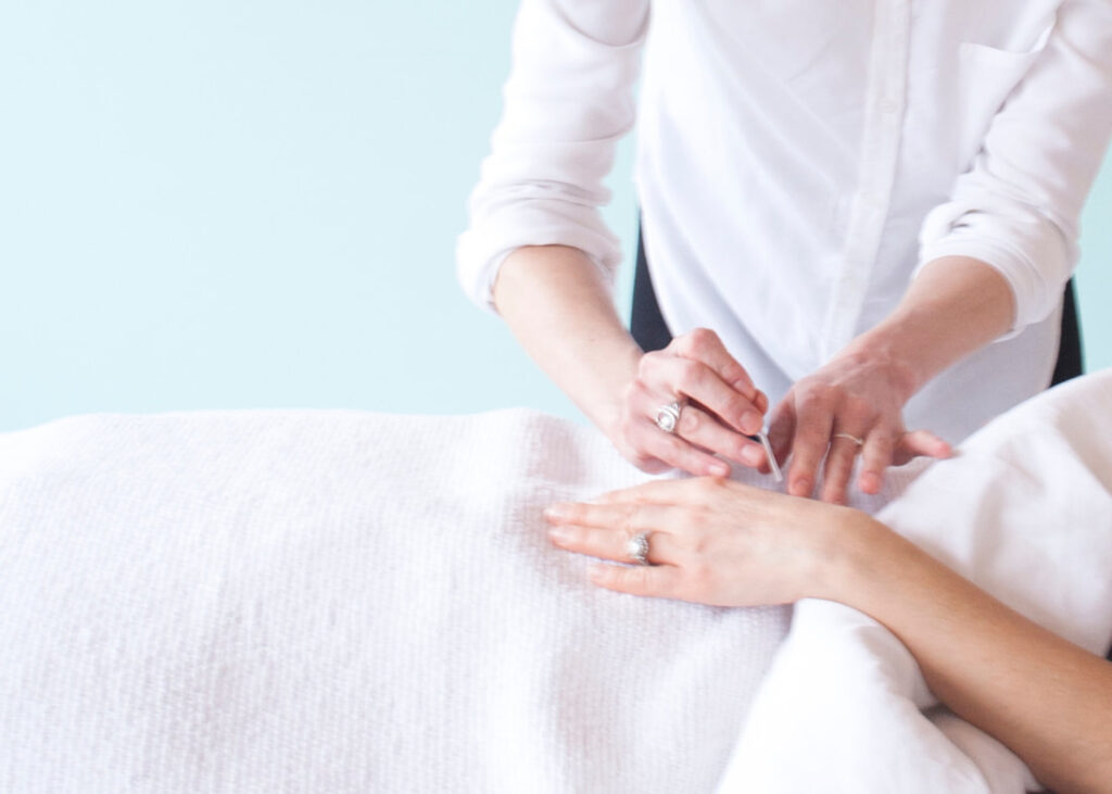 acupuncture in Toronto