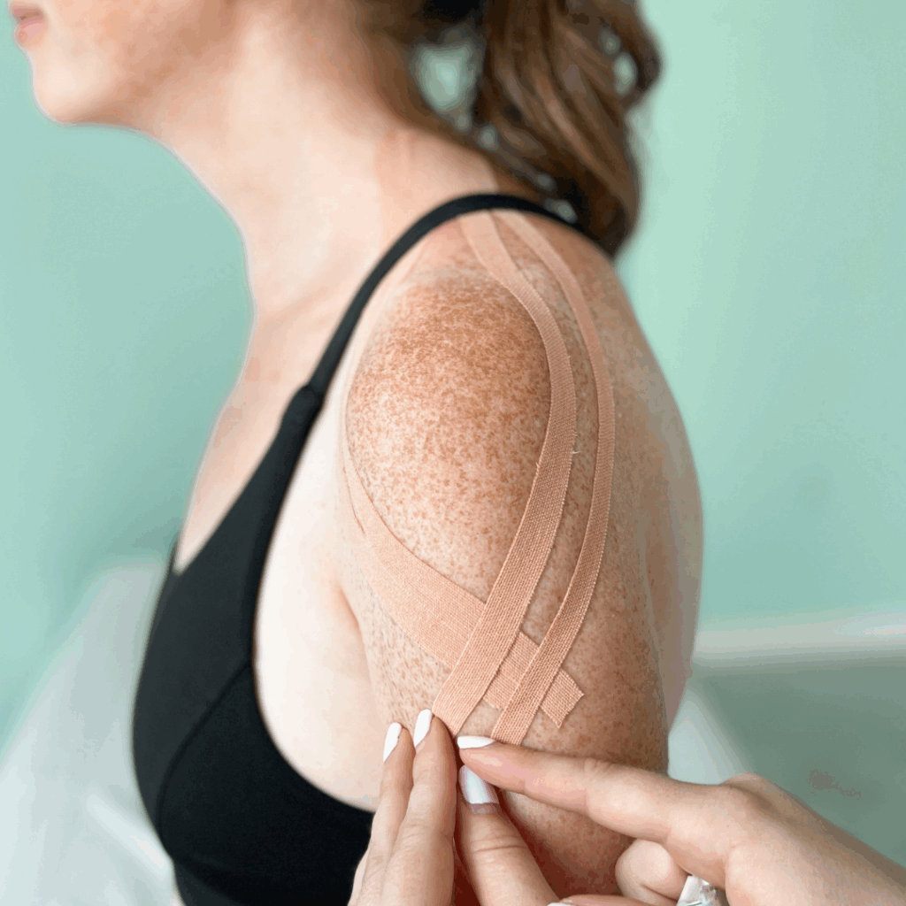 woman receiving kinesio taping by a kinesiologist in Toronto